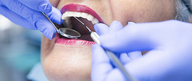 Best Tooth Pain Emergency Relief  in Rollingwood, CA